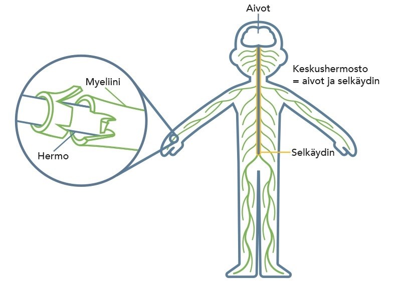 Kuva, josta ilmenee missä aivot, keskushermosto ja selkäydin sijaitsevat sekä myeliini ympäröi hermoa.